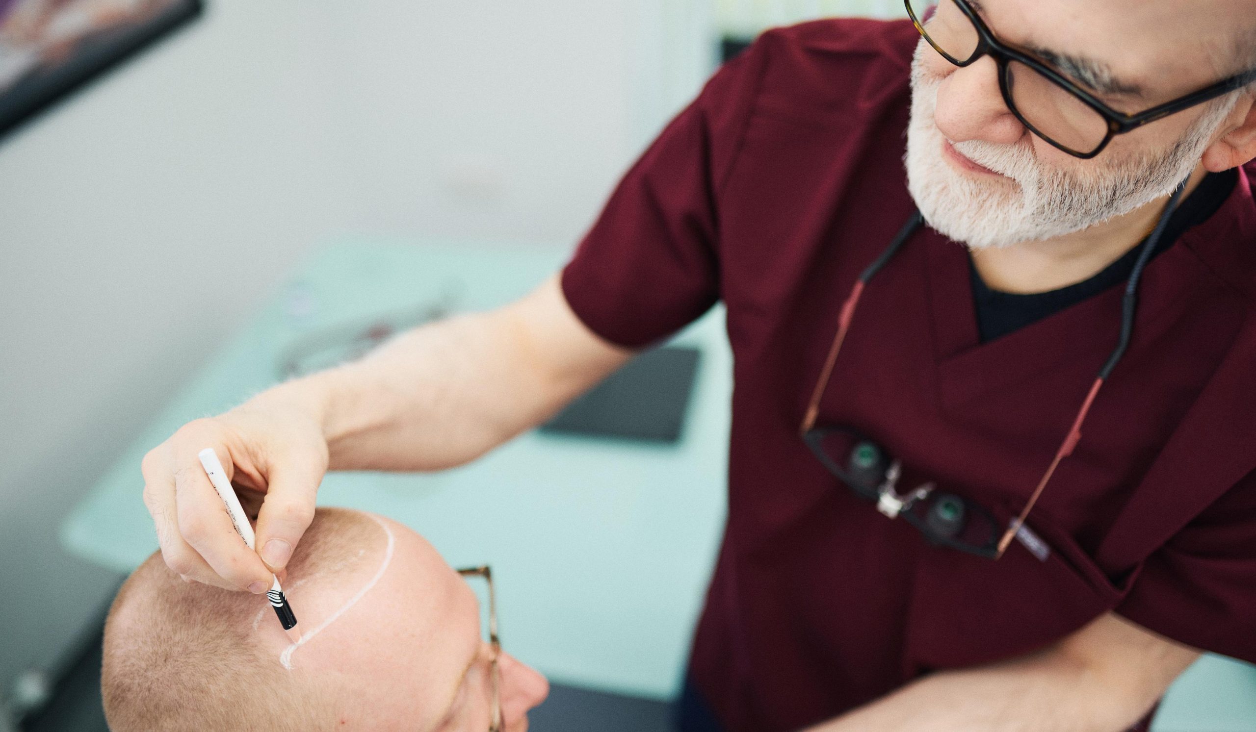 A close-up image shows a hair transplant surgeon meticulously drawing a natural hairline on a patient's scalp with a marker, as the patient sits upright, preparing for the hair restoration surgery. This careful hairline design is crucial for achieving a natural appearance in future hair growth after the hair transplant procedure.